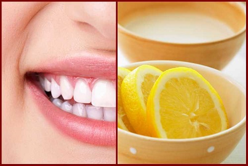 lemon dents Le blanchiment des dents et la revue du kit 3D CREST WHITE lemon